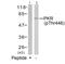 Eukaryotic Translation Initiation Factor 2 Alpha Kinase 2 antibody, PA5-37704, Invitrogen Antibodies, Western Blot image 