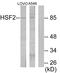 Heat Shock Transcription Factor 2 antibody, LS-C118986, Lifespan Biosciences, Western Blot image 