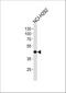 Absent In Melanoma 2 antibody, M00443, Boster Biological Technology, Western Blot image 