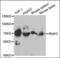 Interleukin 1 Receptor Associated Kinase 3 antibody, orb376328, Biorbyt, Western Blot image 