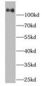 SDC antibody, FNab01425, FineTest, Western Blot image 