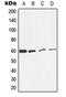 Catalase antibody, MBS8223447, MyBioSource, Western Blot image 