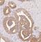 PTPRF Interacting Protein Alpha 1 antibody, FNab04797, FineTest, Immunohistochemistry paraffin image 