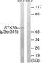Serine/Threonine Kinase 39 antibody, LS-C199616, Lifespan Biosciences, Western Blot image 