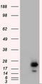 RAB17, Member RAS Oncogene Family antibody, LS-C115258, Lifespan Biosciences, Western Blot image 