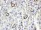 ISG15 Ubiquitin Like Modifier antibody, PB9951, Boster Biological Technology, Immunohistochemistry paraffin image 