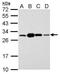 Stratifin antibody, GTX100289, GeneTex, Western Blot image 