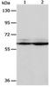Proteasome 26S Subunit, Non-ATPase 3 antibody, orb107433, Biorbyt, Western Blot image 
