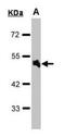 Adrenoceptor Alpha 1A antibody, orb89372, Biorbyt, Western Blot image 