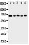 Methyl-CpG Binding Domain 4, DNA Glycosylase antibody, PA2042, Boster Biological Technology, Western Blot image 