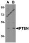 Phosphatase And Tensin Homolog antibody, 3517, ProSci Inc, Western Blot image 
