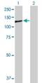 Protein Tyrosine Phosphatase Receptor Type N antibody, H00005798-D01P, Novus Biologicals, Western Blot image 