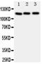 Protein Phosphatase 1 Regulatory Subunit 12A antibody, GTX12027, GeneTex, Western Blot image 