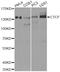 CCCTC-Binding Factor antibody, A1133, ABclonal Technology, Western Blot image 