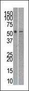 RuvB Like AAA ATPase 2 antibody, PA5-11750, Invitrogen Antibodies, Western Blot image 