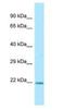 ADP Ribosylation Factor Like GTPase 1 antibody, NBP1-98484, Novus Biologicals, Western Blot image 