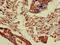 Proline Rich 11 antibody, orb35074, Biorbyt, Immunohistochemistry paraffin image 