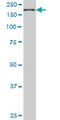 Eukaryotic Translation Initiation Factor 4 Gamma 1 antibody, LS-C197121, Lifespan Biosciences, Western Blot image 