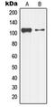 Mitogen-Activated Protein Kinase Kinase Kinase 13 antibody, LS-B13619, Lifespan Biosciences, Western Blot image 