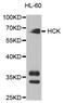 HCK Proto-Oncogene, Src Family Tyrosine Kinase antibody, MBS126978, MyBioSource, Western Blot image 