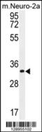 Zinc Finger CCCH-Type Containing 8 antibody, 55-863, ProSci, Western Blot image 
