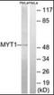 Protein Kinase, Membrane Associated Tyrosine/Threonine 1 antibody, orb96476, Biorbyt, Western Blot image 