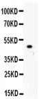 Kinesin Family Member 2C antibody, PA5-79554, Invitrogen Antibodies, Western Blot image 