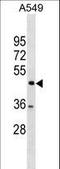 TSPY Like 1 antibody, LS-C157001, Lifespan Biosciences, Western Blot image 