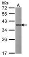 Indolethylamine N-Methyltransferase antibody, GTX119115, GeneTex, Western Blot image 