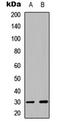 Cyclin Dependent Kinase 5 antibody, LS-C354604, Lifespan Biosciences, Western Blot image 