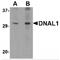 Dynein Axonemal Light Chain 1 antibody, TA306620, Origene, Western Blot image 