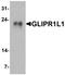 GLIPR1 Like 1 antibody, TA326699, Origene, Western Blot image 