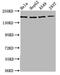 E3 ubiquitin-protein ligase HECW2 antibody, LS-C680580, Lifespan Biosciences, Western Blot image 