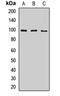Toll Like Receptor 3 antibody, LS-C668270, Lifespan Biosciences, Western Blot image 