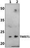 Twist Family BHLH Transcription Factor 1 antibody, A00980, Boster Biological Technology, Western Blot image 
