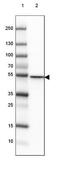 CD2 Cytoplasmic Tail Binding Protein 2 antibody, NBP2-47516, Novus Biologicals, Western Blot image 