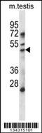 Histone Deacetylase 11 antibody, 58-113, ProSci, Western Blot image 