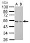 Coagulation Factor X antibody, NBP1-33320, Novus Biologicals, Western Blot image 