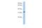 Family With Sequence Similarity 216 Member A antibody, A17948, Boster Biological Technology, Western Blot image 