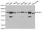 Insulin Like Growth Factor 2 MRNA Binding Protein 1 antibody, A13581, ABclonal Technology, Western Blot image 