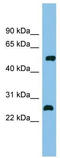 Myocyte Enhancer Factor 2D antibody, TA343568, Origene, Western Blot image 