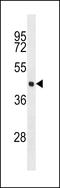 Eukaryotic Translation Initiation Factor 4A3 antibody, LS-C159519, Lifespan Biosciences, Western Blot image 