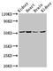 NADH:Ubiquinone Oxidoreductase Core Subunit S2 antibody, LS-C673624, Lifespan Biosciences, Western Blot image 