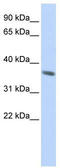 Keratin 222 antibody, TA338827, Origene, Western Blot image 