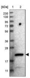 Coiled-Coil Domain Containing 25 antibody, NBP1-83821, Novus Biologicals, Western Blot image 