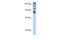 Homeodomain Interacting Protein Kinase 2 antibody, GTX30803, GeneTex, Western Blot image 