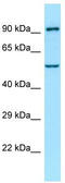 Atlastin-1 antibody, TA337733, Origene, Western Blot image 