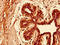 Keratin 81 antibody, LS-C396919, Lifespan Biosciences, Immunohistochemistry paraffin image 
