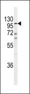 Endothelin Converting Enzyme 1 antibody, LS-C167608, Lifespan Biosciences, Western Blot image 