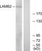 Laminin Subunit Beta 2 antibody, GTX87258, GeneTex, Western Blot image 